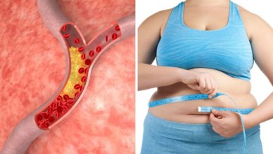 10 Risikofaktoren für hohe Cholesterinwerte und wie man sie senkt